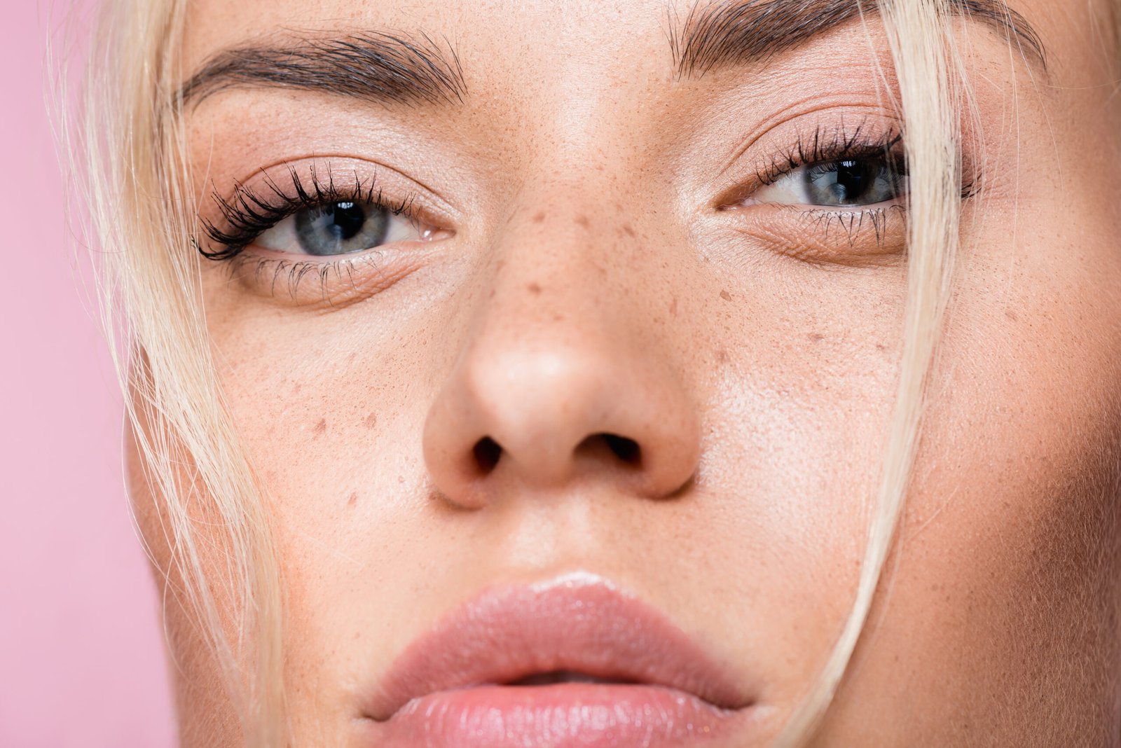 girl with clean face / neurotoxins photo