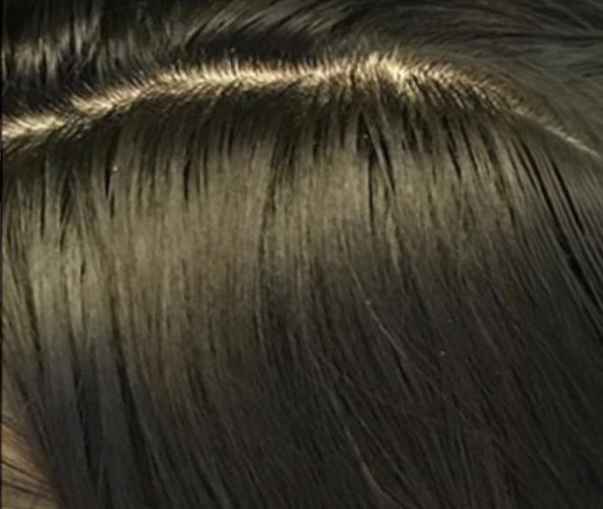 Hair After