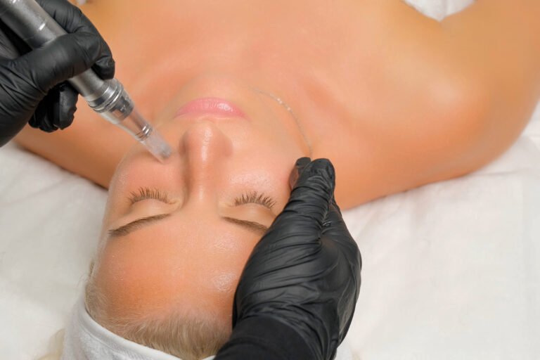 Microneedling