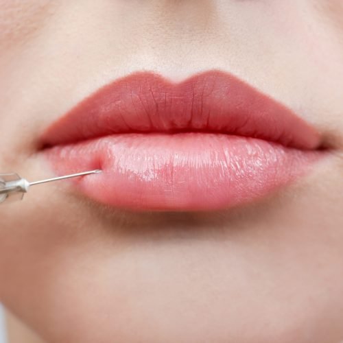 Beautiful young woman receiving filler injection in lips, closeup