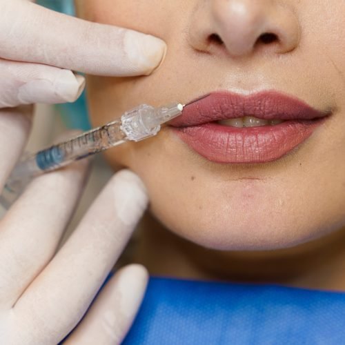 Close-up lips augmentation injections for attractive girl. Plastic surgeon does injection in lip in medical clinic. Cosmetic rejuvenating facial treatment. Empty space for advert