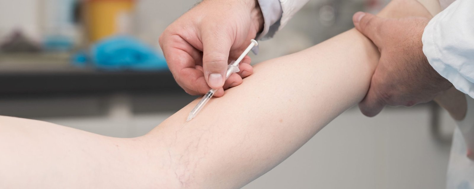 Surgery and Medical theme: Doctor performs sclerotherapy for varicose veins on the legs, varicose vein treatment, copy space, injection. Surgery and Medical theme: Doctor performs sclerotherapy for varicose veins on the legs, varicose vein treatment, copy space, injection.