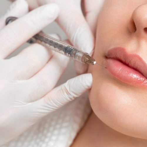 A woman makes lip shape correction in a cosmetology clinic. Lips injections, lip augmentation