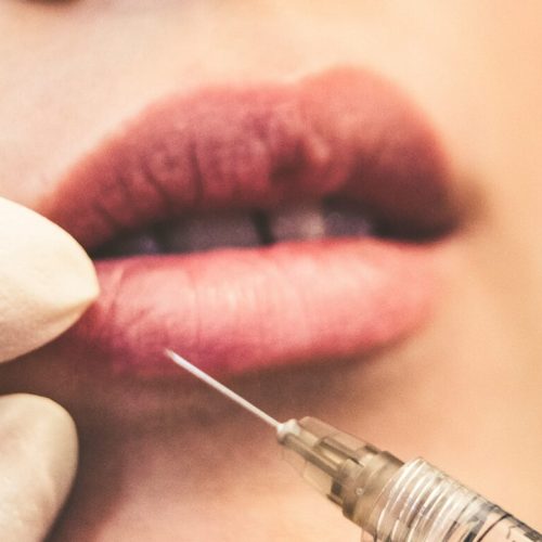 Lip Filler Aftercare Tips for Tampa Residents