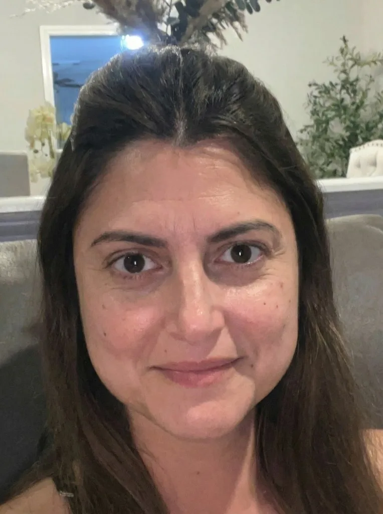 Eric — before treatment