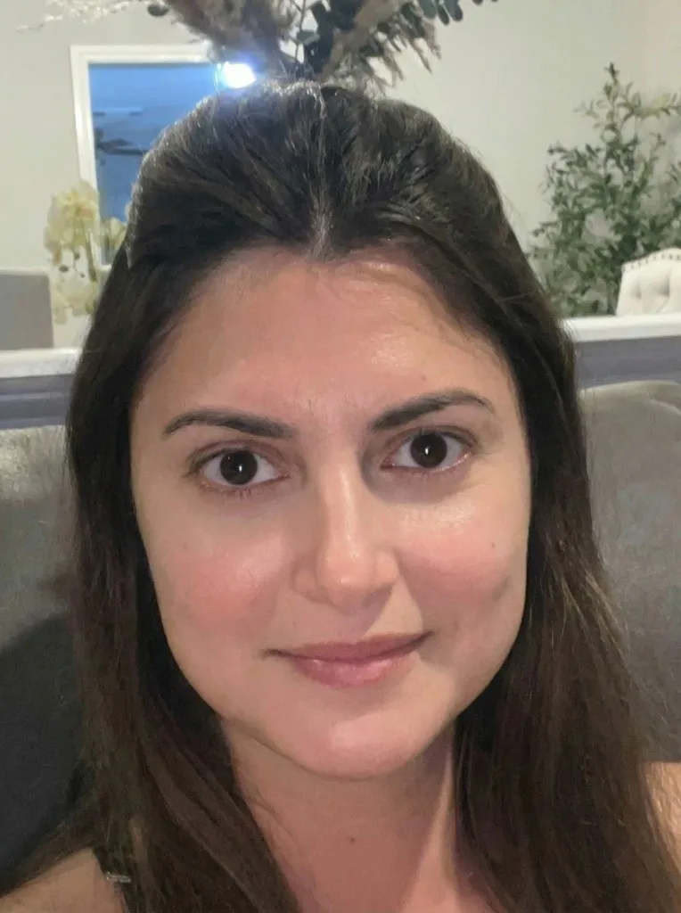 Eric — AI preview after treatment