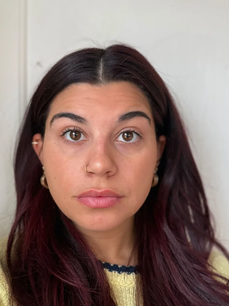 Courtney — before treatment